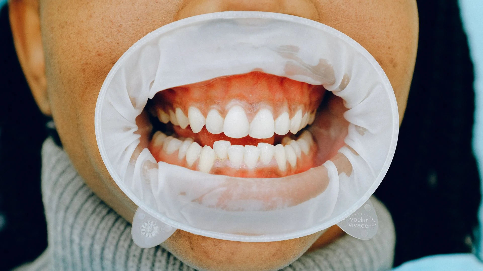 Periodontia — Odontubel